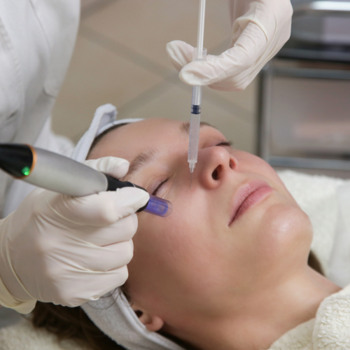 Micro-Needling